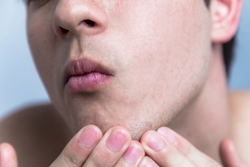 Skincare for men: an expert's guide to help you protect your skin, fight acne, and feel good