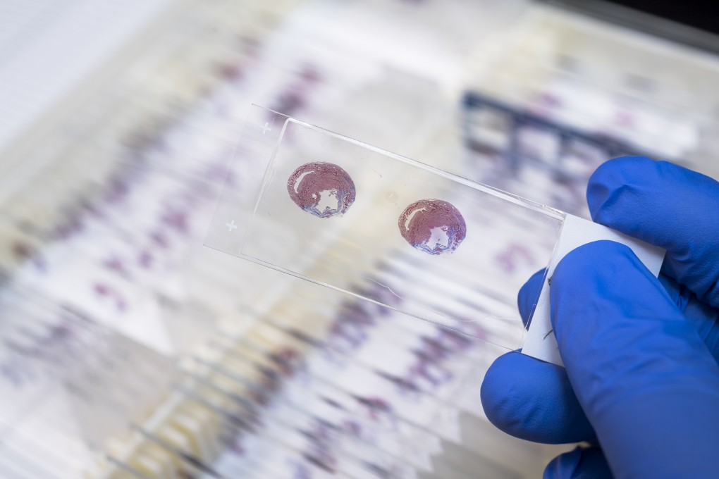 These are the specimens of rats’ hearts used in the research.