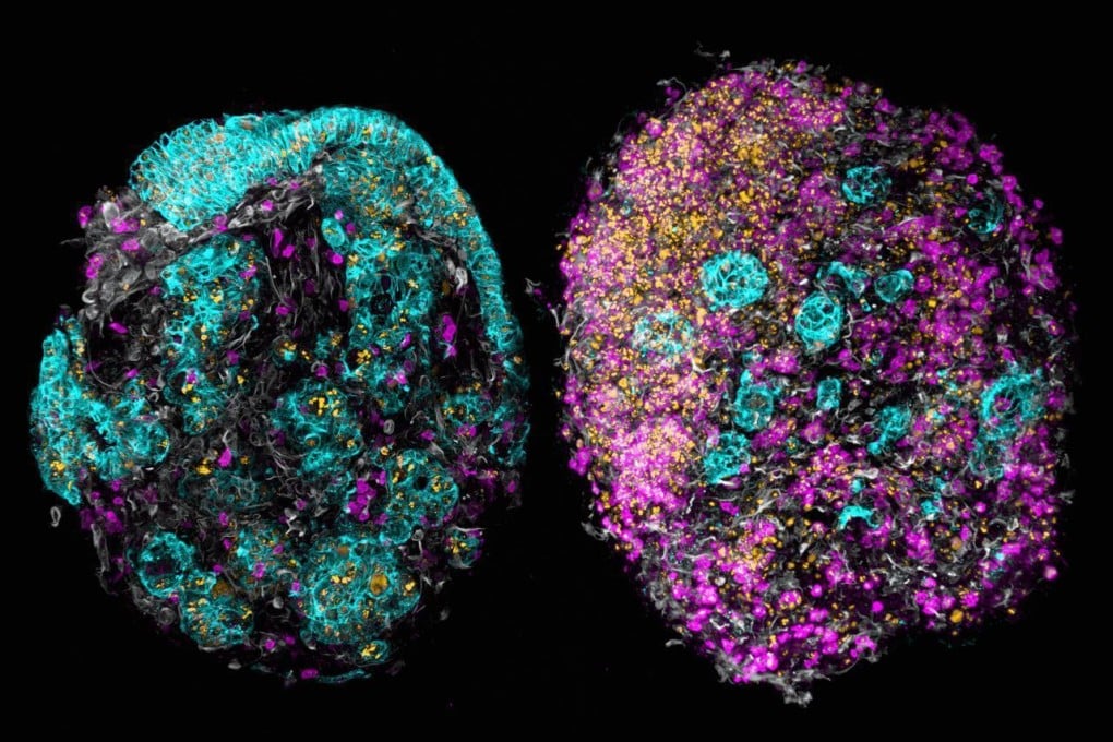 3D Insights into Novel Cancer Models. The imagery is scientifically oriented and may depict medical or biological subjects in explicit detail.