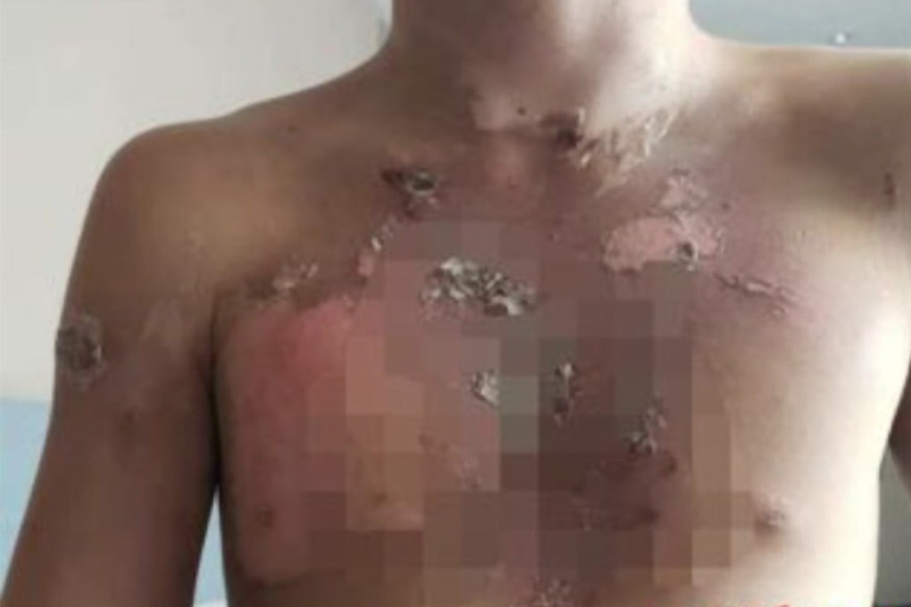 Each victim was allegedly strangled repeatedly till they lost consciousness then again scalded with boiling water. Photo: Handout