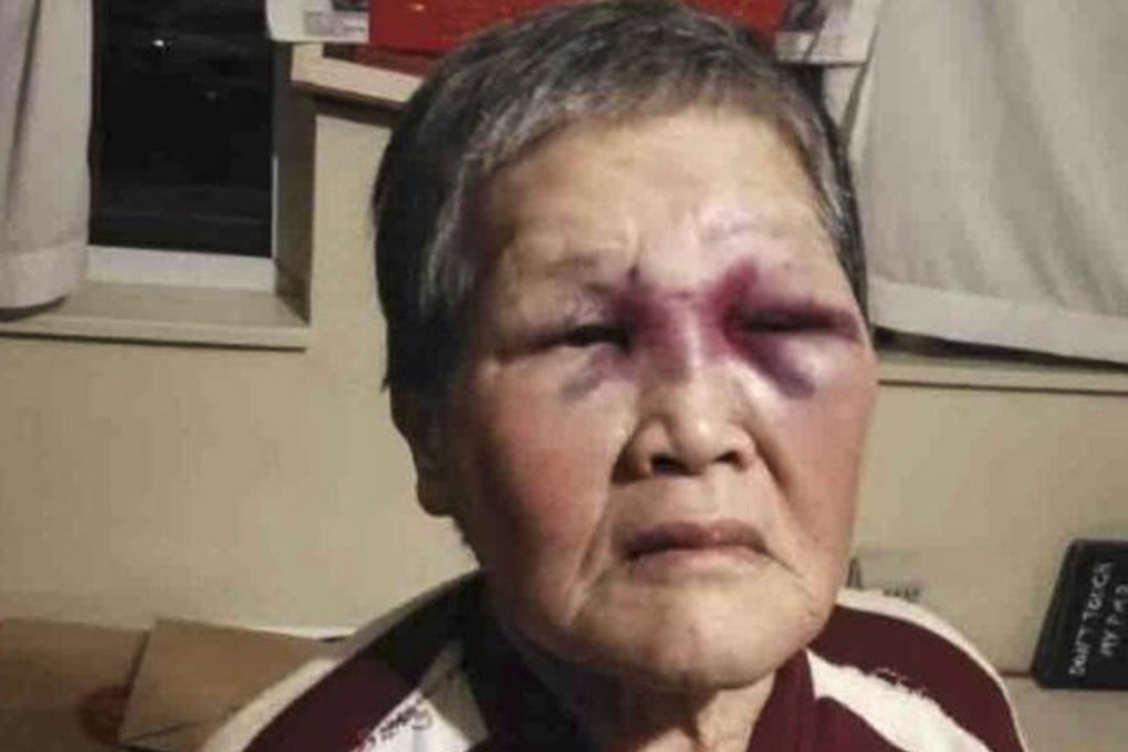 Anti Asian rhetoric has risen in the past year. 76-year-old Xie Xiaozhen fought back against her racist attacker. Photo: Gofundme
