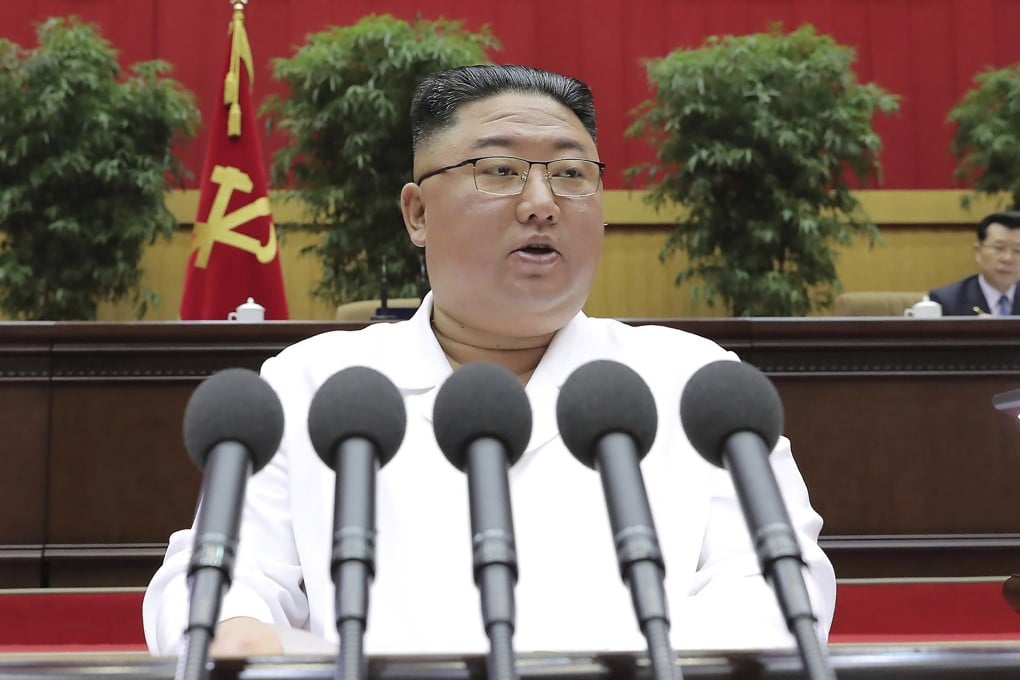North Korean leader Kim Jong-un. Photo: AP