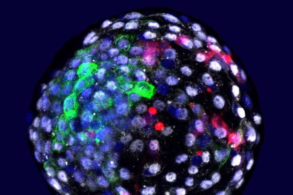 Researchers created mixed embryos as a potential future source of organs for transplants. Photo: Handout
