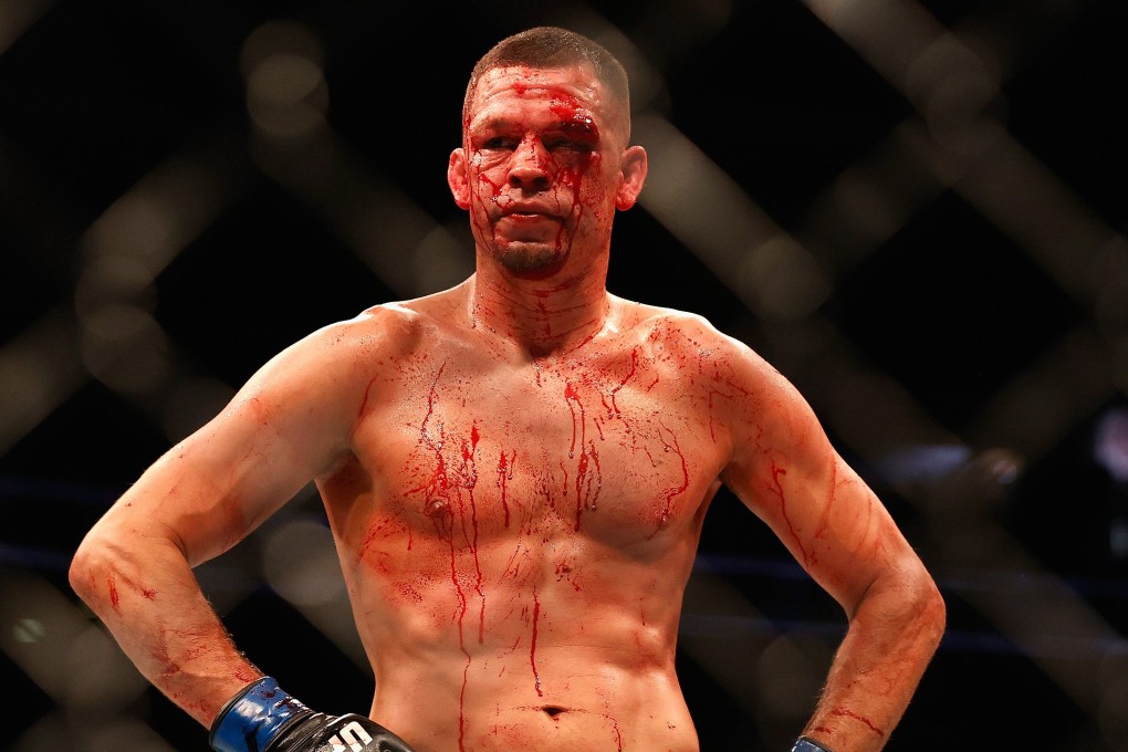 UFC welterweight fighter Nate Diaz after his fight against division contender Leon Edwards at UFC 263 in the Gila River Arena, Arizone in June. Photo: AFP