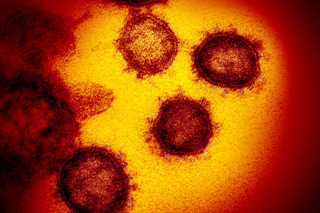 The WHO has already identified four “variants of concern”. Photo:  EPA-EFE