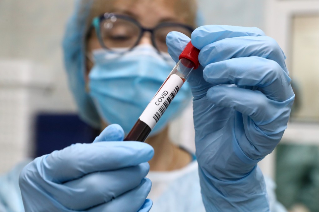 The presence of antibodies in an antibody test is a sign of a previous infection, or that a vaccine is working to protect an individual, but the quantity of these proteins does not directly correlate to the level of immunity. Photo: TASS via Getty Images