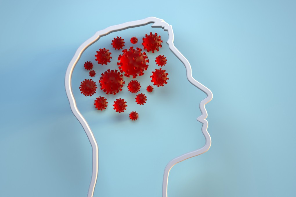 People are slowly coming out of the pandemic, but there is a lot of trauma to process. Not only that, our brains have changed, too. How do we reverse the mental damage Covid-19 has caused? Photo: Getty Images