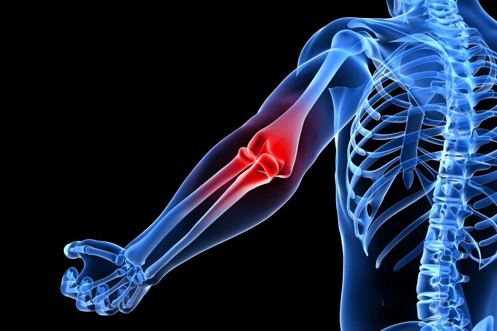 The elbow is a vital and sensitive joint and prone to injury. Photo: Shutterstock