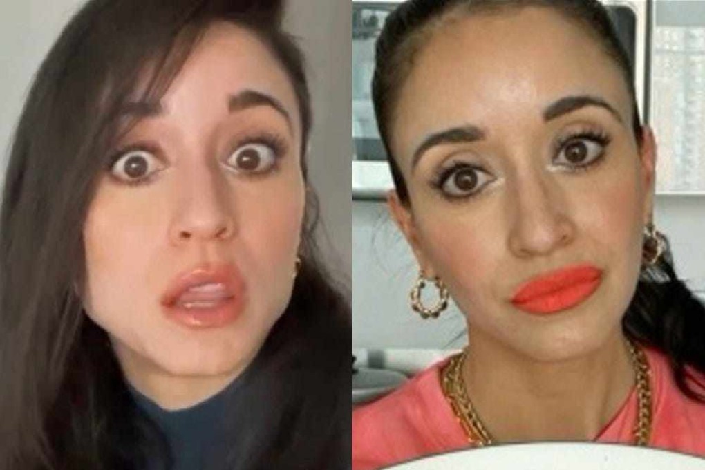 Writer Marisel Salazar before and after Botox. She got Botox to treat her jaw pain and migraines, and discovered some surprising things along the way.