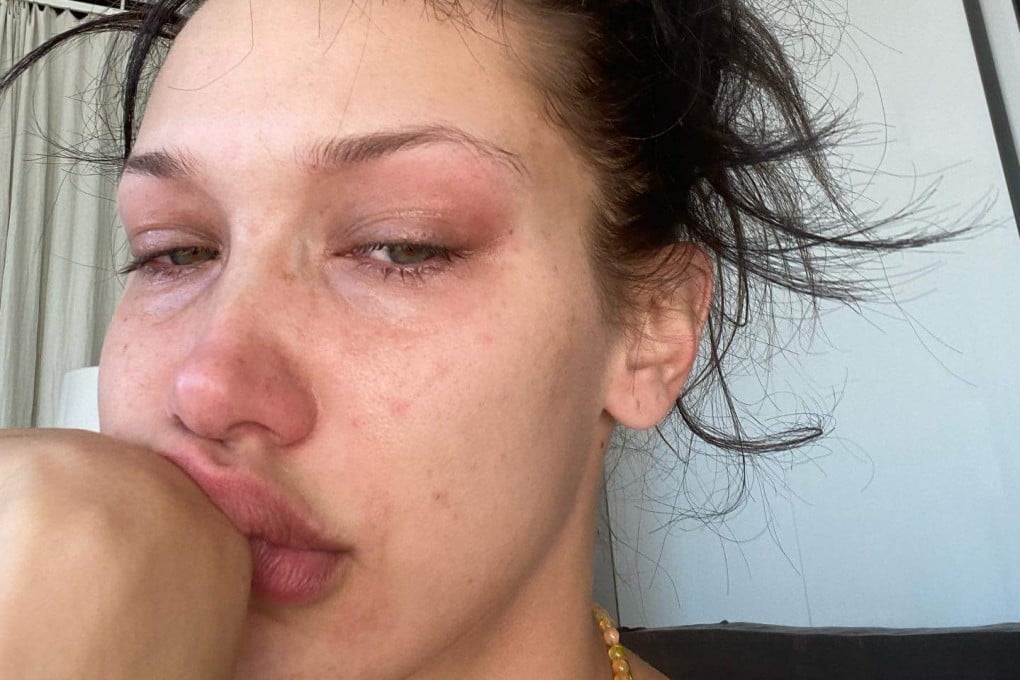 Model Bella Hadid’s post of herself crying in reaction to singer Willow Smith’s admission of anxiety and insecurity garnered millions of likes on Instagram in an example of celebrity worship. Photo: Instagram/@bellahadid