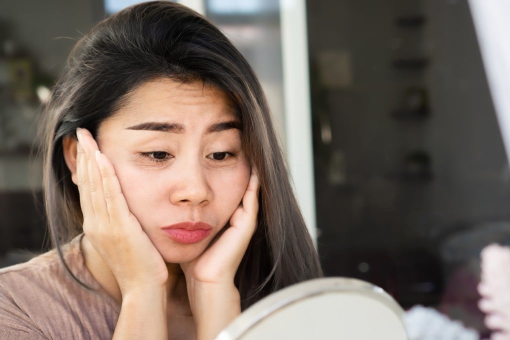 Stress can age the skin and increase oil production, causing inflammation, acne and rosacea. The remedies are more simple than you think. Photo: Shutterstock