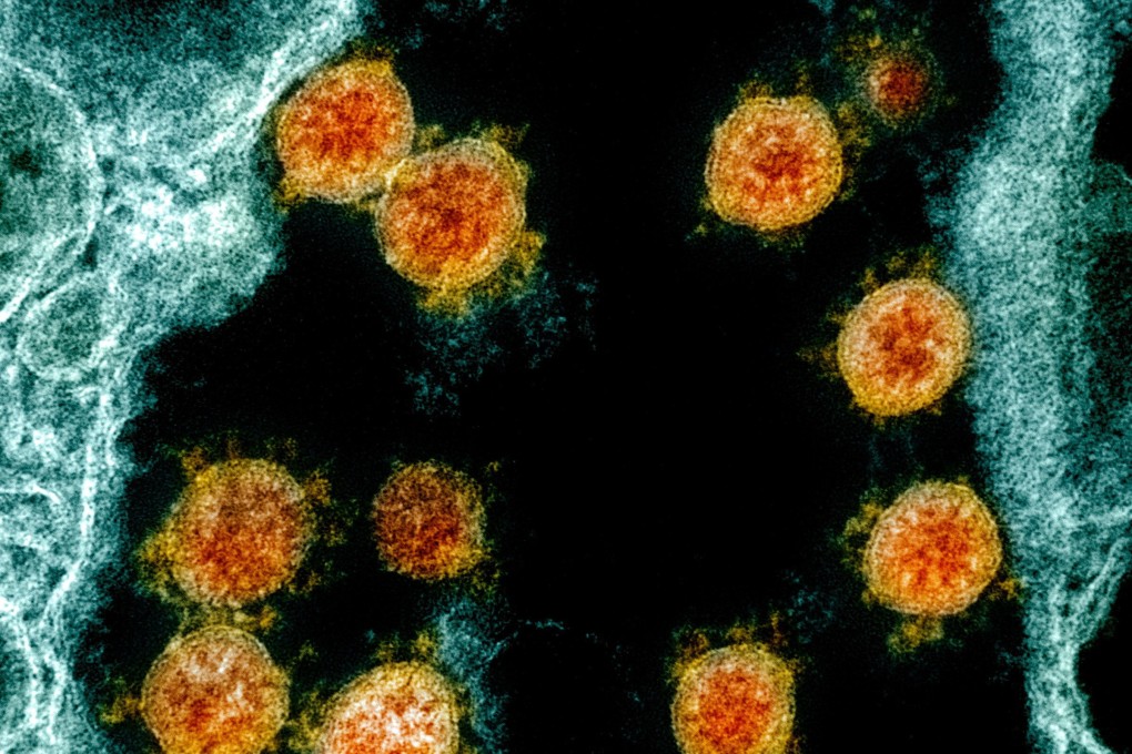 The coronavirus has mutated and evolved several times since gripping the world in a pandemic. Photo: EPA-EFE