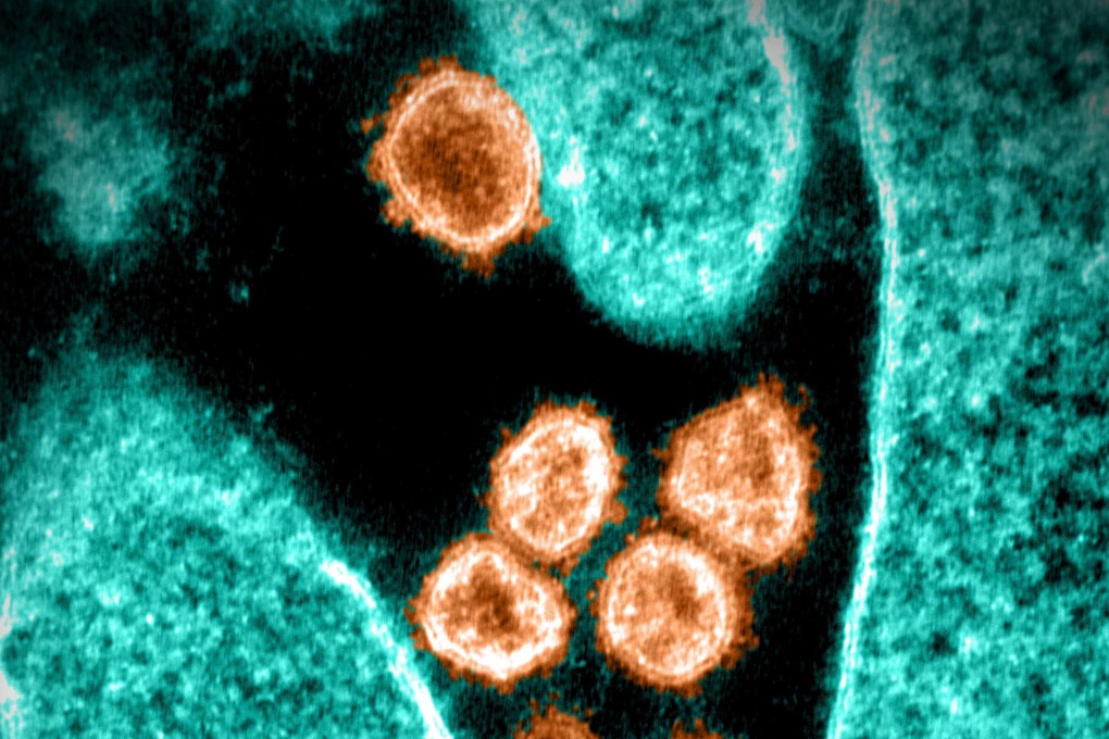 An electron microscope image shows the Sars-CoV-2 virus that causes Covid-19 emerging from the surface of a cell cultured in the lab. Image: National Institute of Allergy and Infectious Diseases via AFP