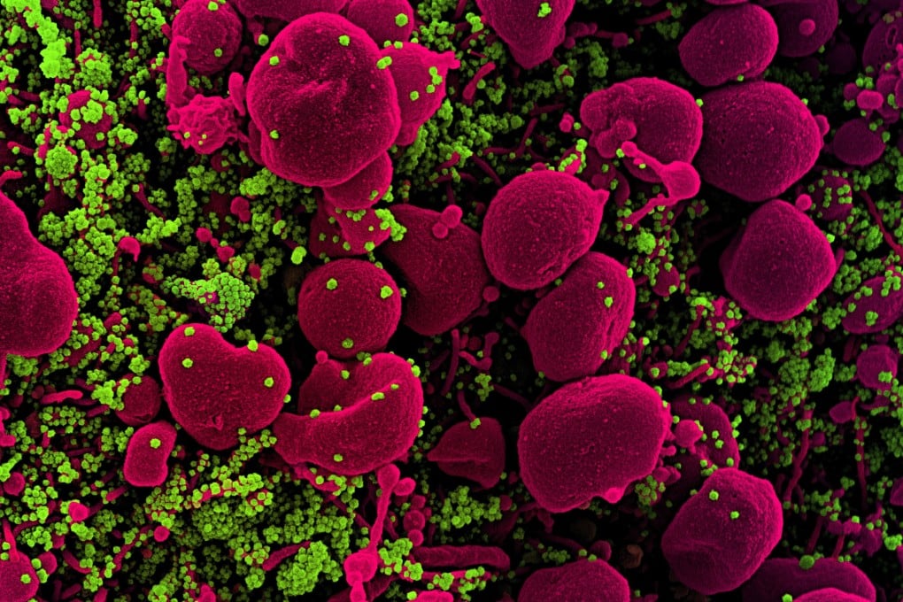 The WHO and the European Union have been pushing for a “pandemic treaty” for months. Photo: EPA