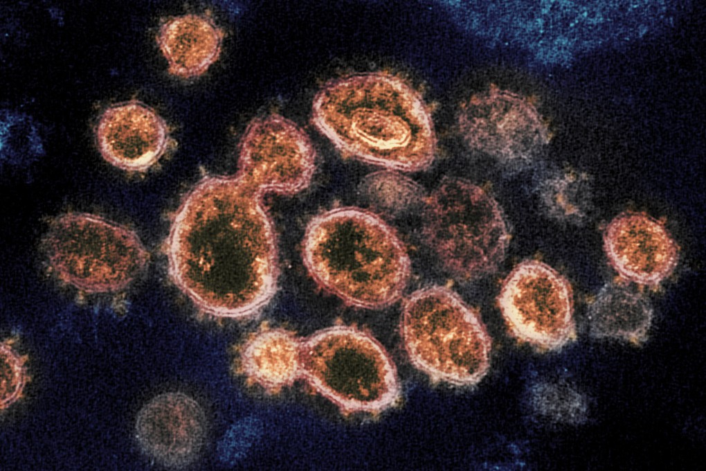 The US has repeatedly criticised China as not being forthcoming on the origins of the coronavirus. Photo: AP