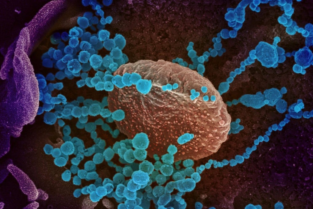 An electron microscope image of the original Covid-19 coronavirus (round blue objects) emerging from the surface of cells cultured in the lab. Photo: NIH via AFP