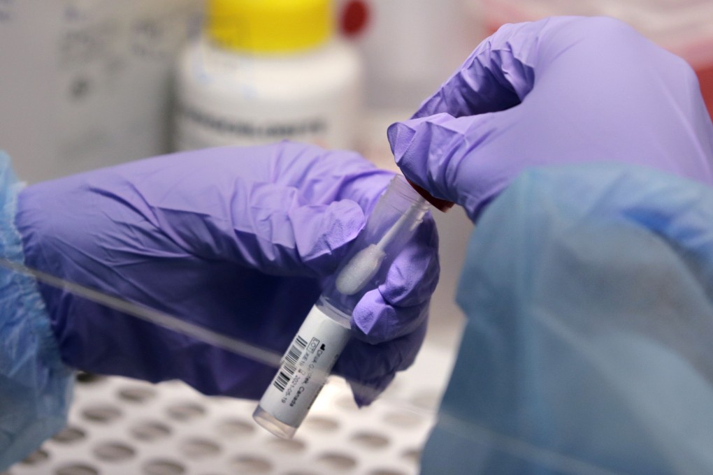 The US has improved its surveillance system for tracking new coronavirus variants such as Omicron, boosting its capacity by tens of thousands of samples since early 2021. Photo: AP