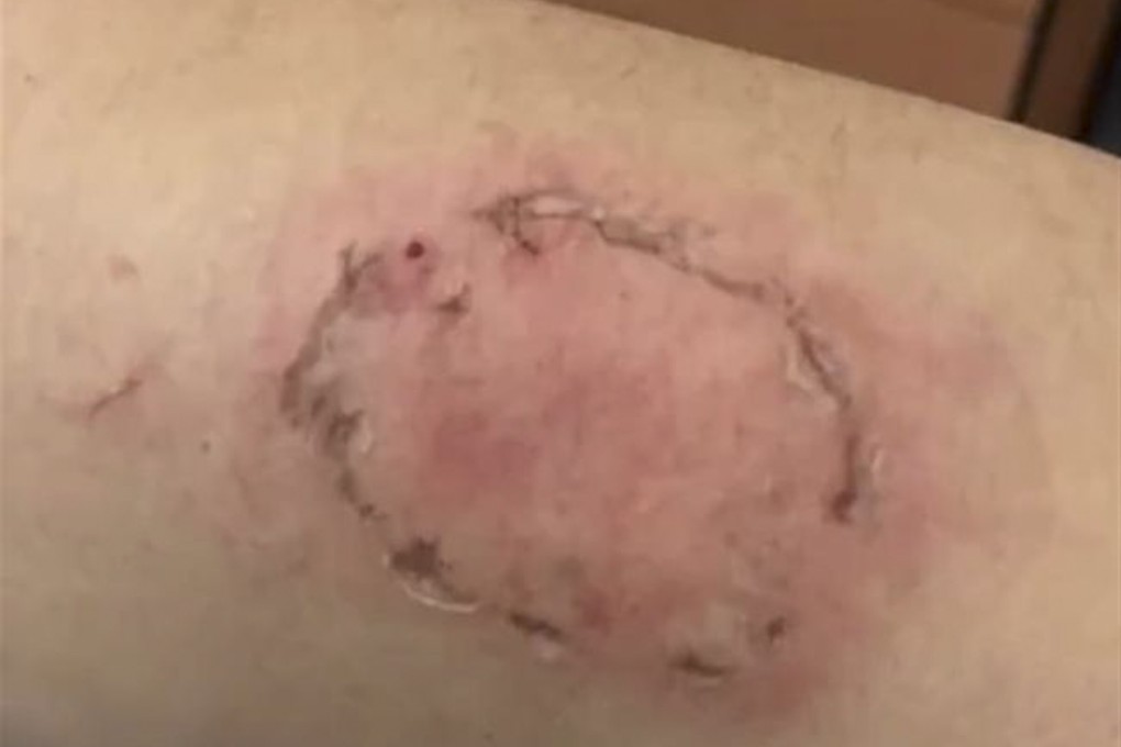 A man strangled and bitten more than 10 times by a stranger in a bizarre case of mistaken identity: 163.com