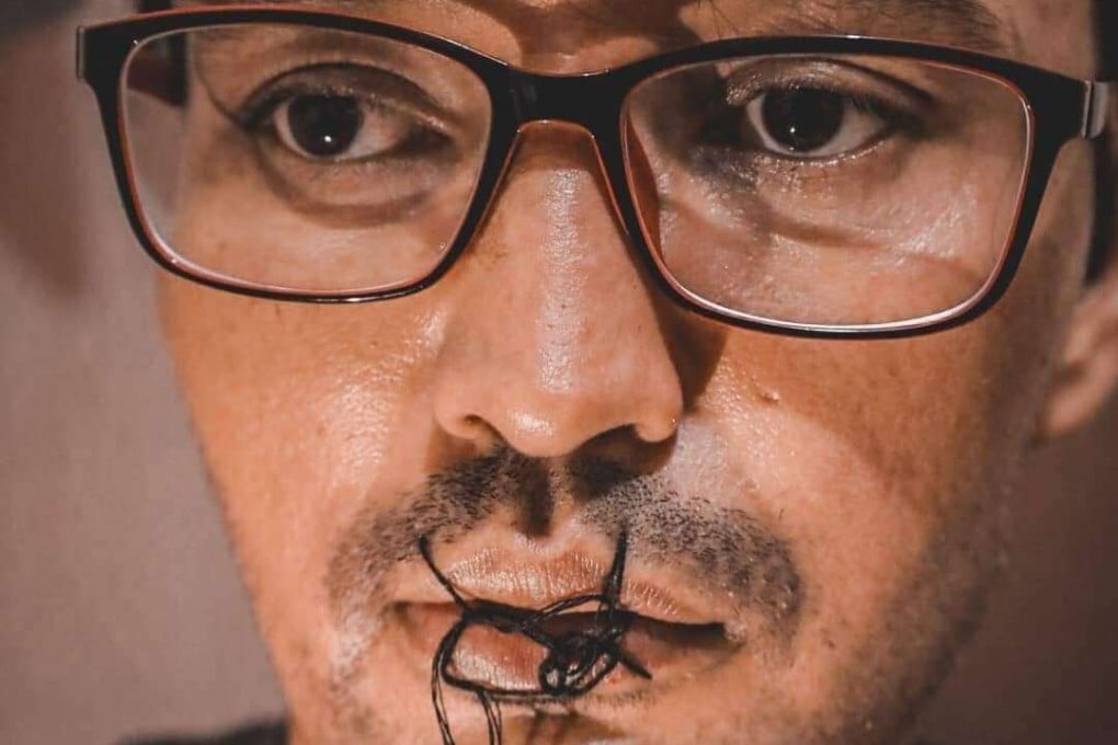 Refugees in Pekanbaru in Riau sewed their lips shut in protest at their lack of resettlement status. Photo: Handout