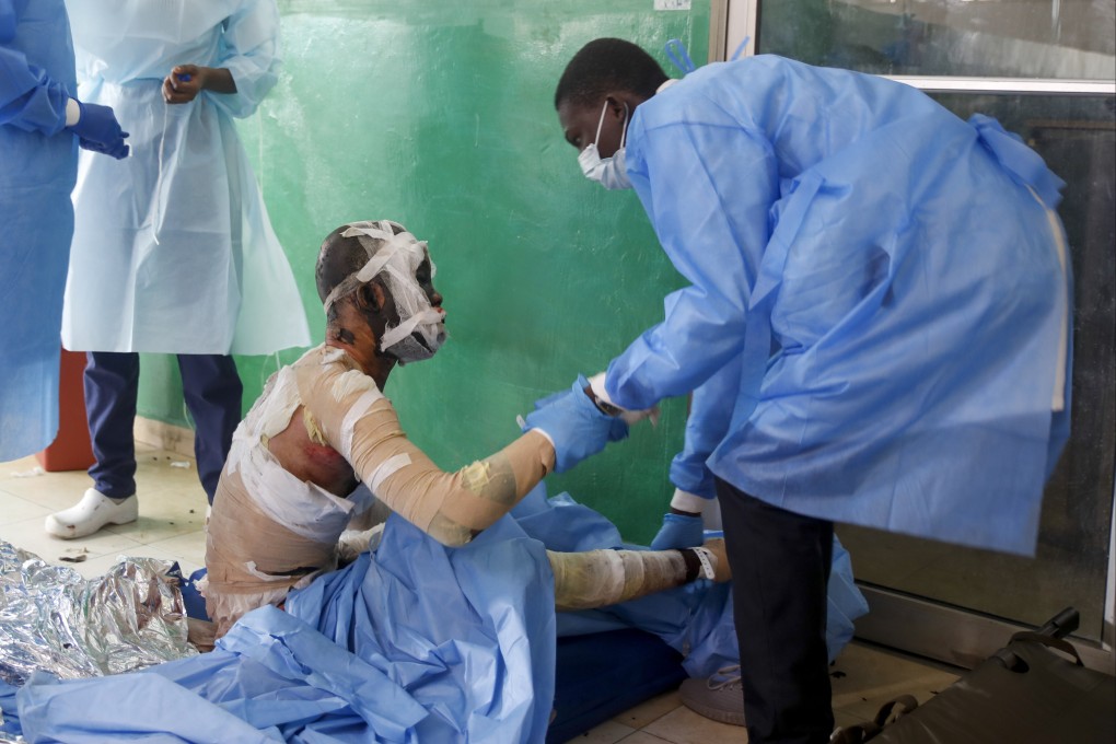 A health worker attends a man who was burned after a fuel truck overturned and exploded in Cap-Haitien, Haiti. Photo: AP