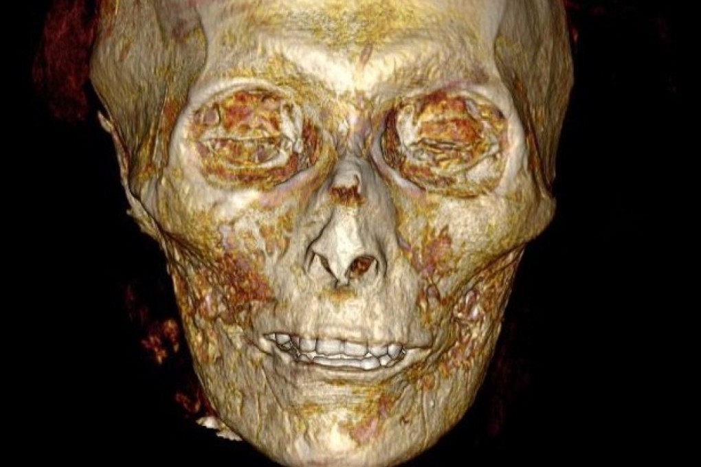 An image of the head of King Amenhotep I created using computed tomography (CT) scanning, in Cairo, Egypt. Photo: EPA-EFE / Egyptian Ministry of Antiquities