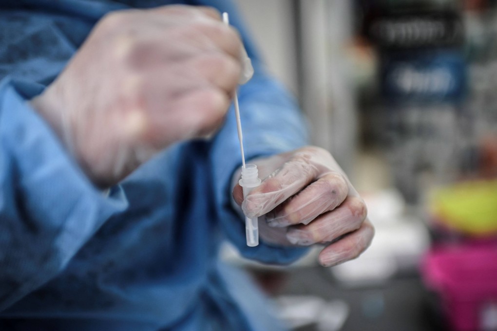 A sample collected from a patient tested for the Covid-19 in Paris. File photo: AFP