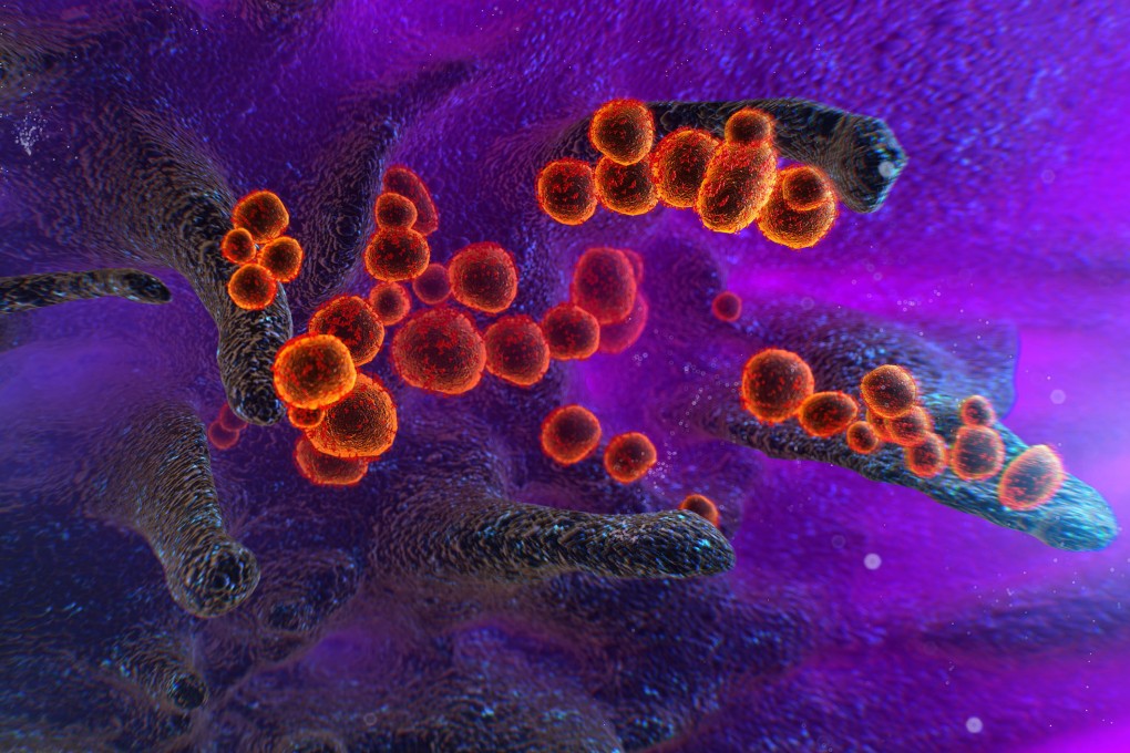 The virus that causes Covid-19 emerging from the surface of cells. Photo: Shutterstock