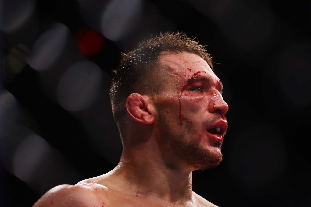 Michael Chandler looks on against Justin Gaethje in their lightweight bout at UFC 268 inside Madison Square Garden in New York City. Photo: Mike Stobe/Getty Images/AFP
