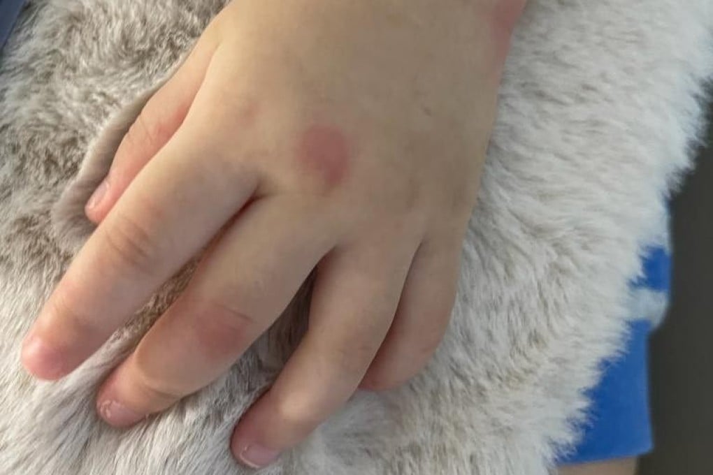 Lam’s one-year-old son waited several days for help from health authorities after testing positive for the coronavirus on Saturday. Photo: Handout