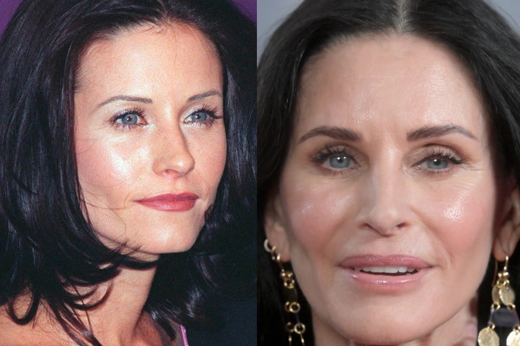 Courteney Cox in 1996 and in 2022. The actress, 57, says she tried to chase youthfulness and “didn’t realise that ... I’m actually looking really strange with injections and doing stuff to my face”. Photos: Shutterstock/Getty Images