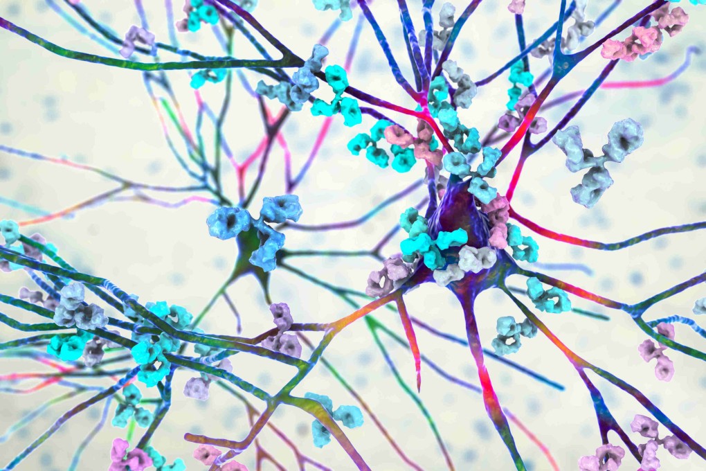 An illustration of antibodies attacking a neuron. Most doctors have little knowledge of how to diagnose and treat rare diseases. Advances in science are helping to change this. Photo: Shutterstock
