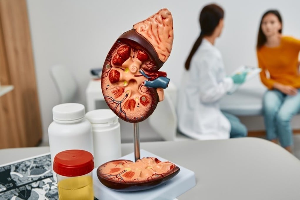 The major function of the kidneys is to remove waste products and excess fluid from the body. The right diet can help avoid and manage problems with the organ later in life. Photo: Shutterstock