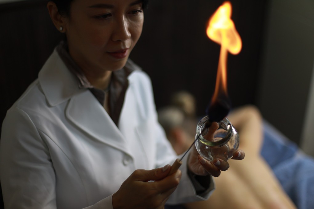 Cupping, a form of traditional Chinese medicine (TCM), involves warming a glass cup and placing it on the patient’s skin to open the pores. Photo courtesy of Master Ruth Lee