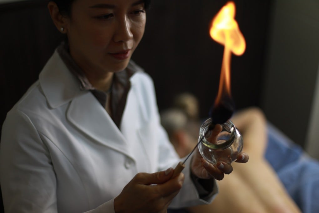 Cupping, a form of traditional Chinese medicine (TCM), involves warming a glass cup and placing it on the patient’s skin to open the pores. Photo courtesy of Master Ruth Lee