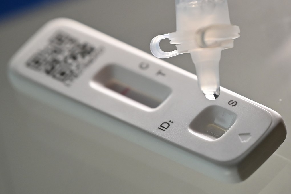 China has approved RAT kits from five companies for general use. Photo: AFP
