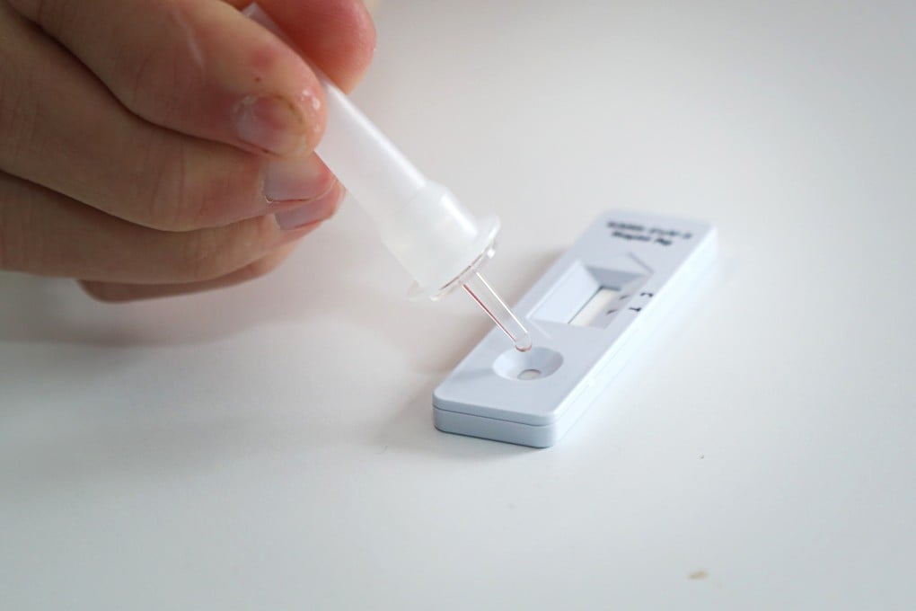 As part of a new policy, mainland Chinese residents can use the kits without the help of health care professionals. Photo: WGP