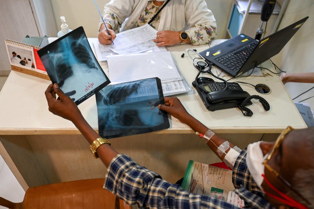 A TB patient holds his chest X-rays during a consultation with a doctor at the Médecins Sans Frontières clinic in Mumbai earlier this month. Photo: AFP