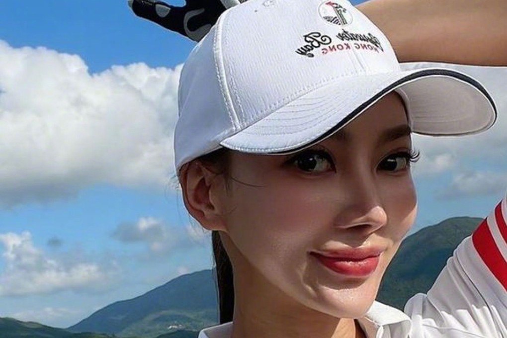 Natalie Cheung said in a social media post that her injuries were a result of losing her footing while she was drunk. Photo: Weibo