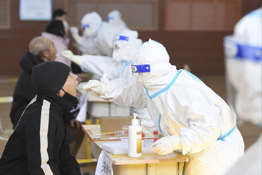 The new test is quicker and cheaper than nucleic acid tests. Photo: Xinhua