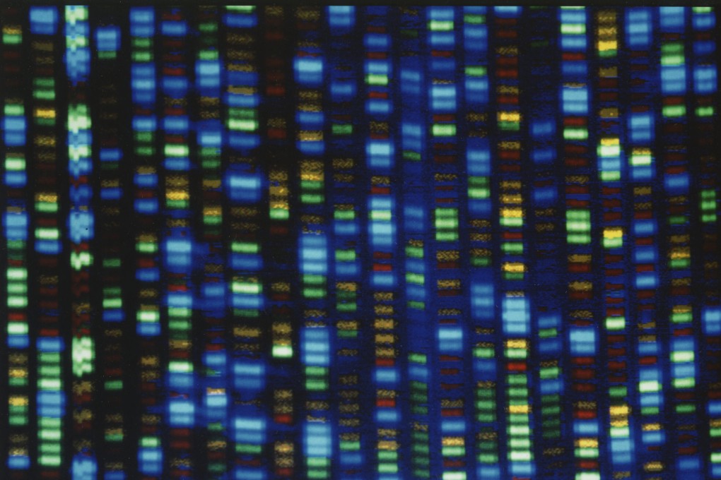 The output from a DNA sequencer is seen in an undated image. Photo: National Human Genome Research Institute via AP