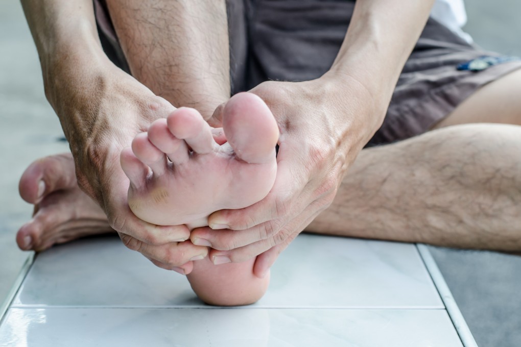 An ingrown toenail can be painful and prevent you from running. Photo: Shutterstock
