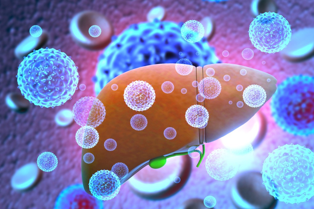 Liver Infection with hepatitis viruses. 3d illustration