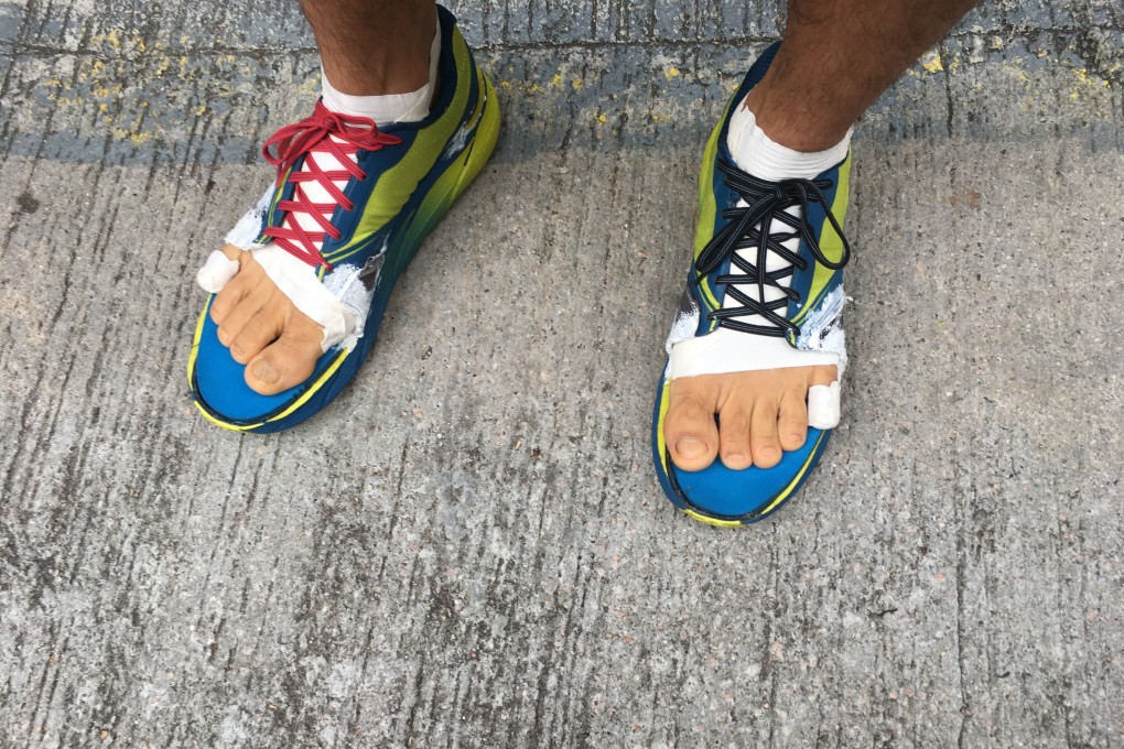 How to know when it’s time to change your shoes - or like Phairat Varasin (pictured),  experiment with barefoot running. Photo: Mark Agnew