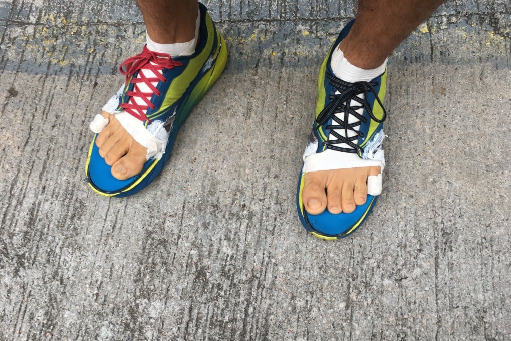 How to know when it’s time to change your shoes - or like Phairat Varasin (pictured), experiment with barefoot running. Photo: Mark Agnew