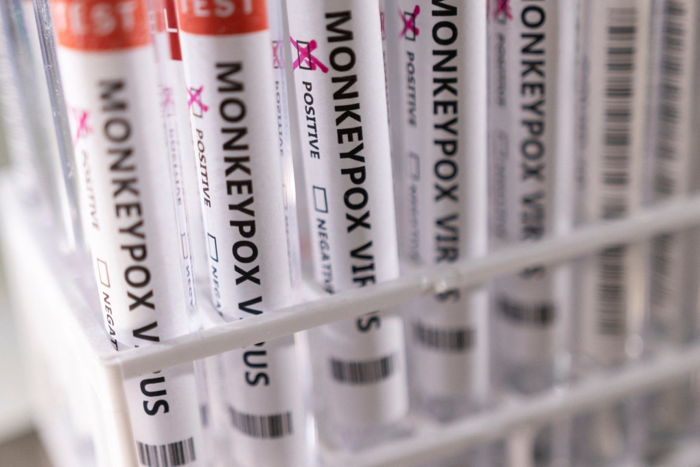 Test tubes labelled ‘monkeypox virus positive’. Photo: Reuters