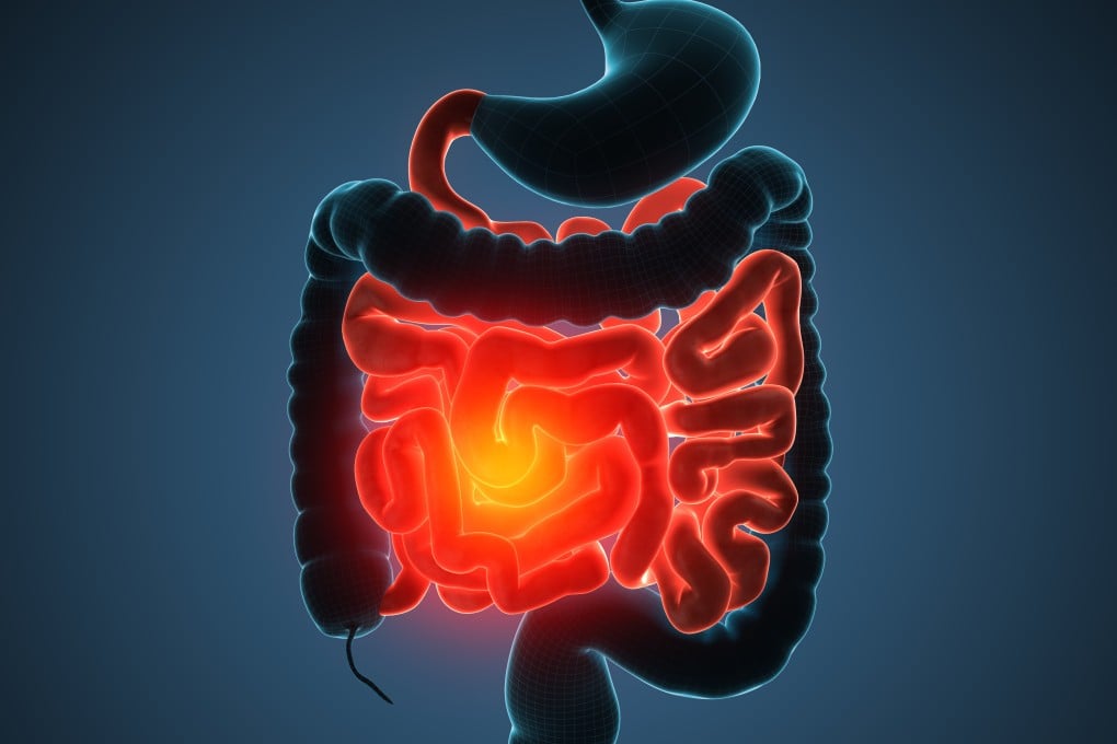 Experts explain the different types of inflammation and the potential risks, and provide advice on how sleep, whole foods and exercise can make it go away. Photo: Shutterstock