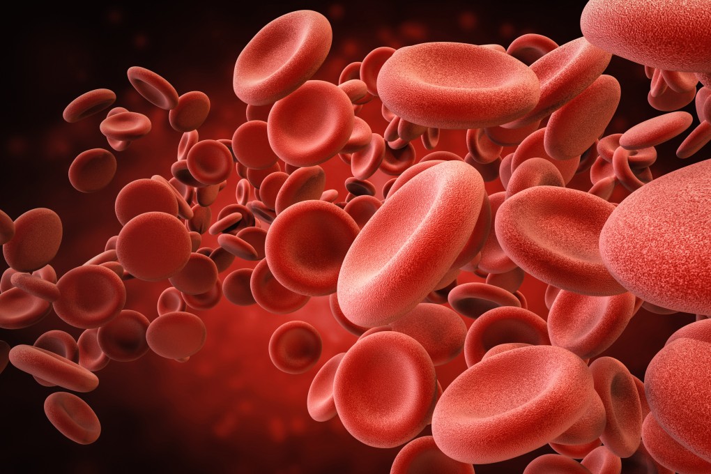 China has about 120,000 haemophilia patients and about 40,000 registered patients, of which 75-80 per cent are haemophilia A patients and 15-20 per cent are haemophilia B patients, according to haematologist Zhang Lei. Photo: Shutterstock