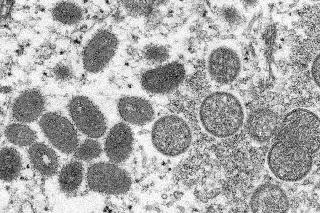 Hong Kong has been on guard against monkeypox. Photo: AFP