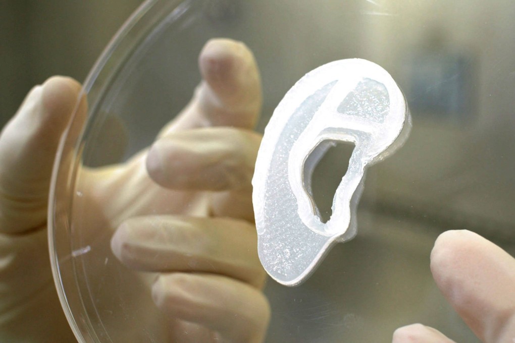 A 3D bioimplant of an ear lobe that was developed by 3DBio Therapeutics.  Photo: 3DBio Therapeutics via AFP