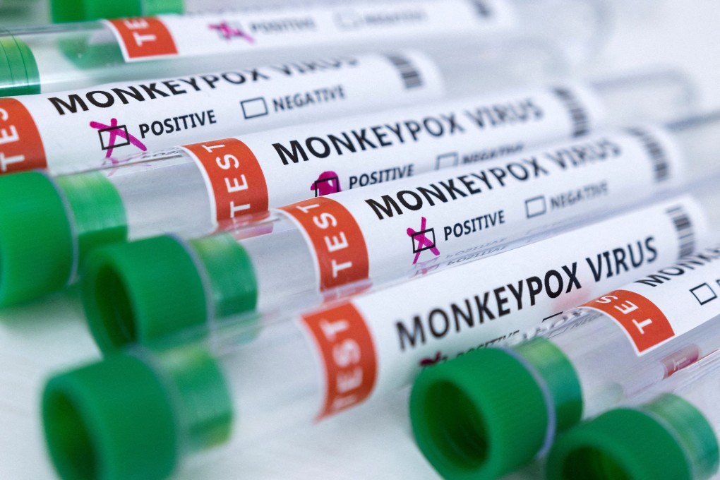 At least 700 people worldwide currently have monkeypox. Photo: Reuters